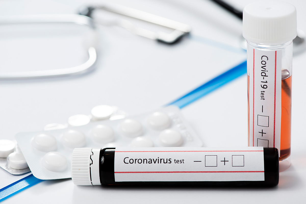 Koroonaviirus Eestis, 13. september: ööpäevaga lisandus 21 positiivset testi