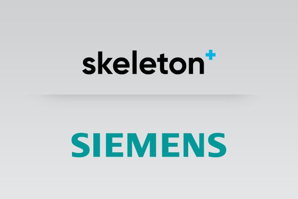 Eesti Skeleton Technologies sai Siemensilt suurinvesteeringu ja ületas miljardi piiri Eesti Skeleton Technologies sai Siemensilt suurinvesteeringu ja ületas miljardi piiri